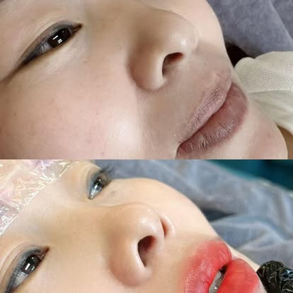 ME Beauty close-up treatment result photo from Facebook